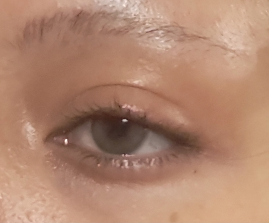 UGC003181