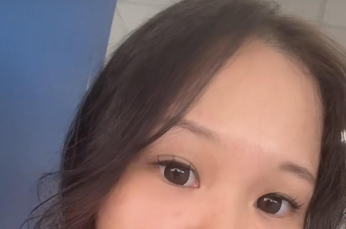 UGC005079