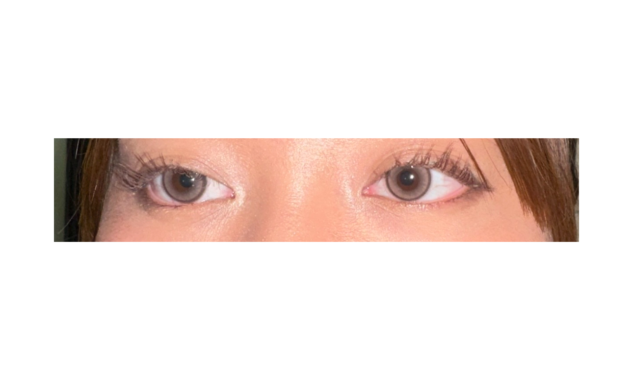 UGC003924