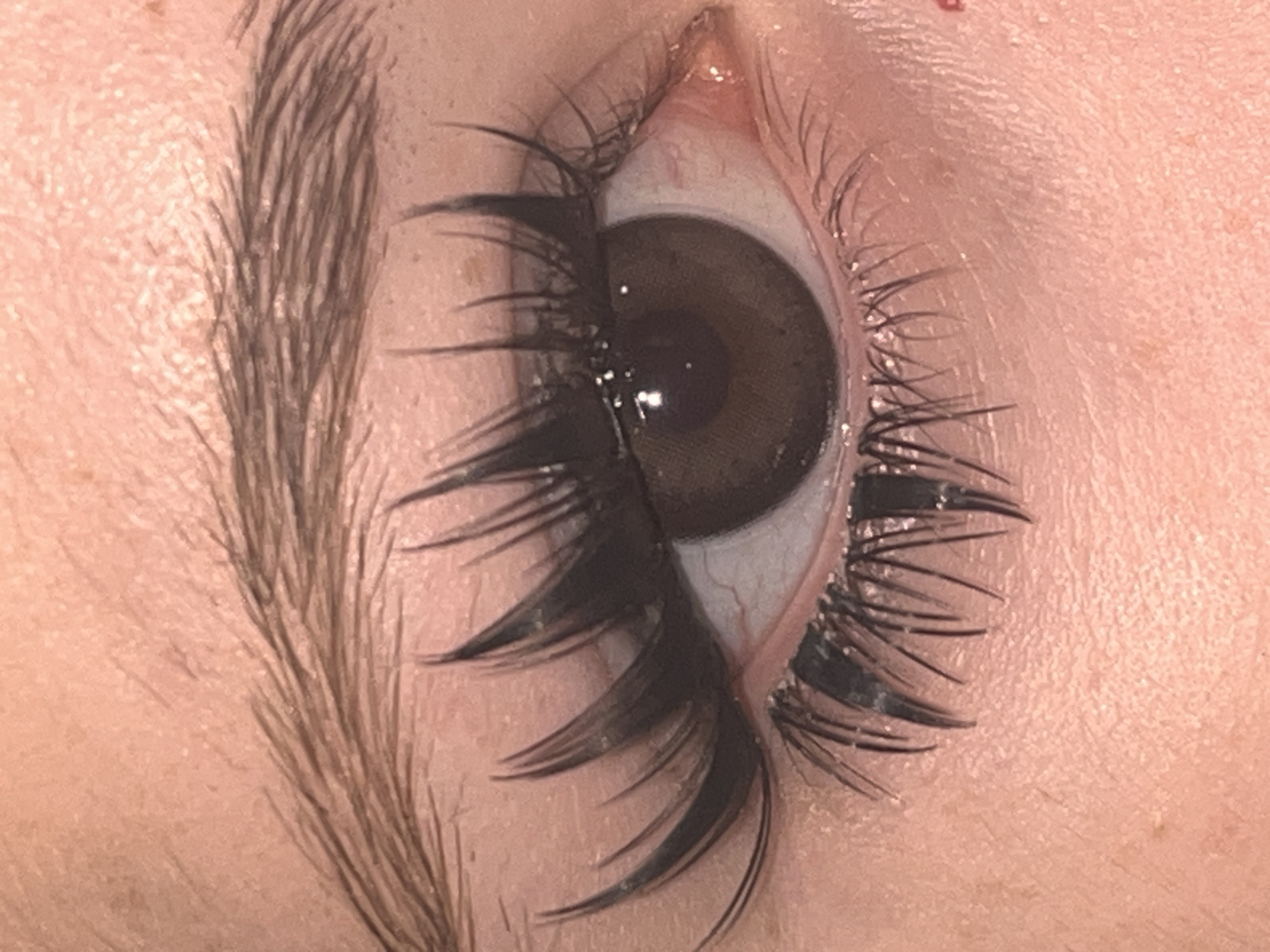 UGC007394