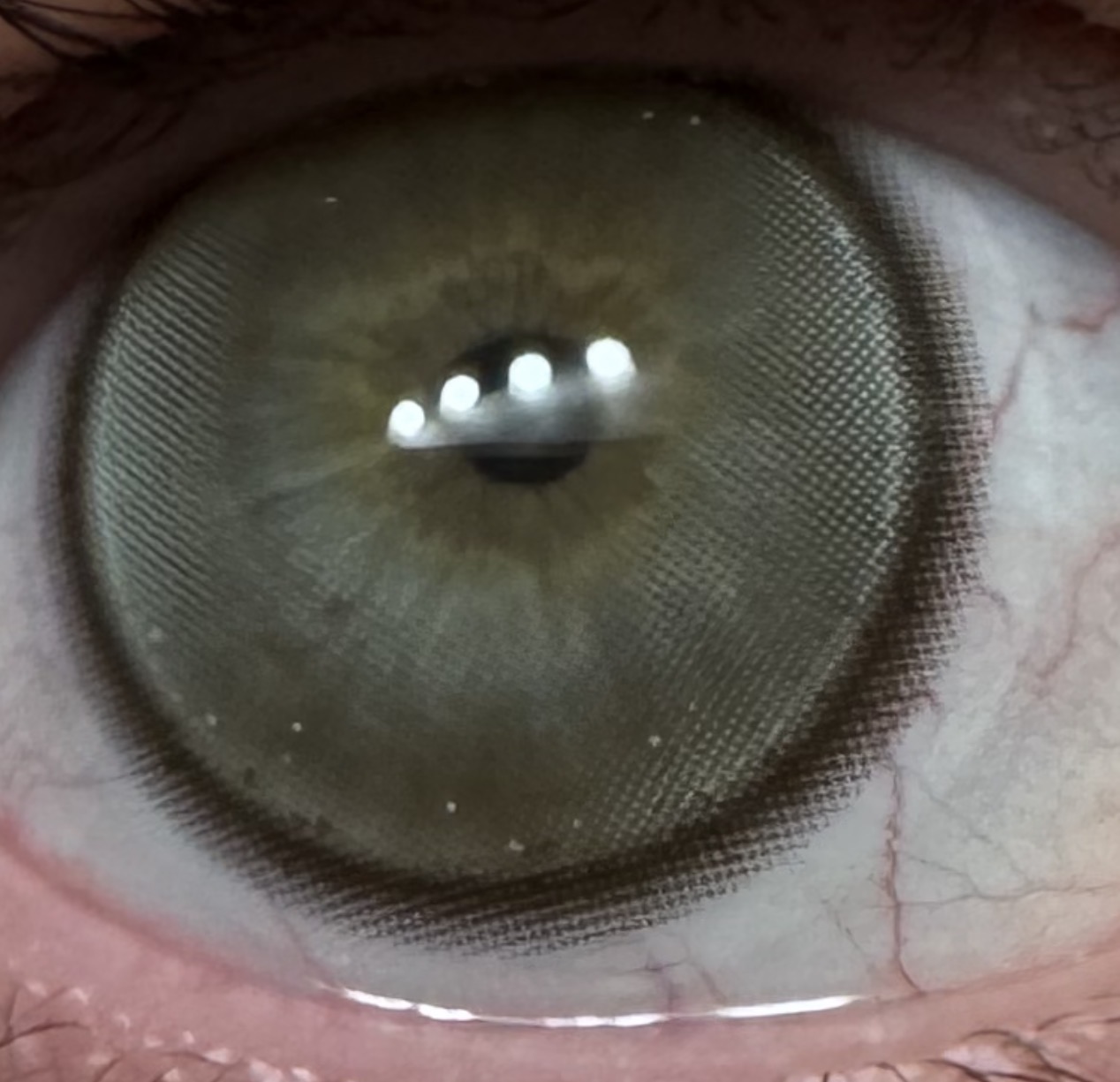 UGC008638