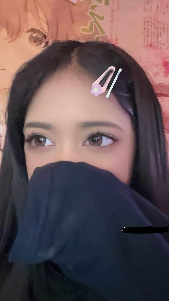 UGC003555