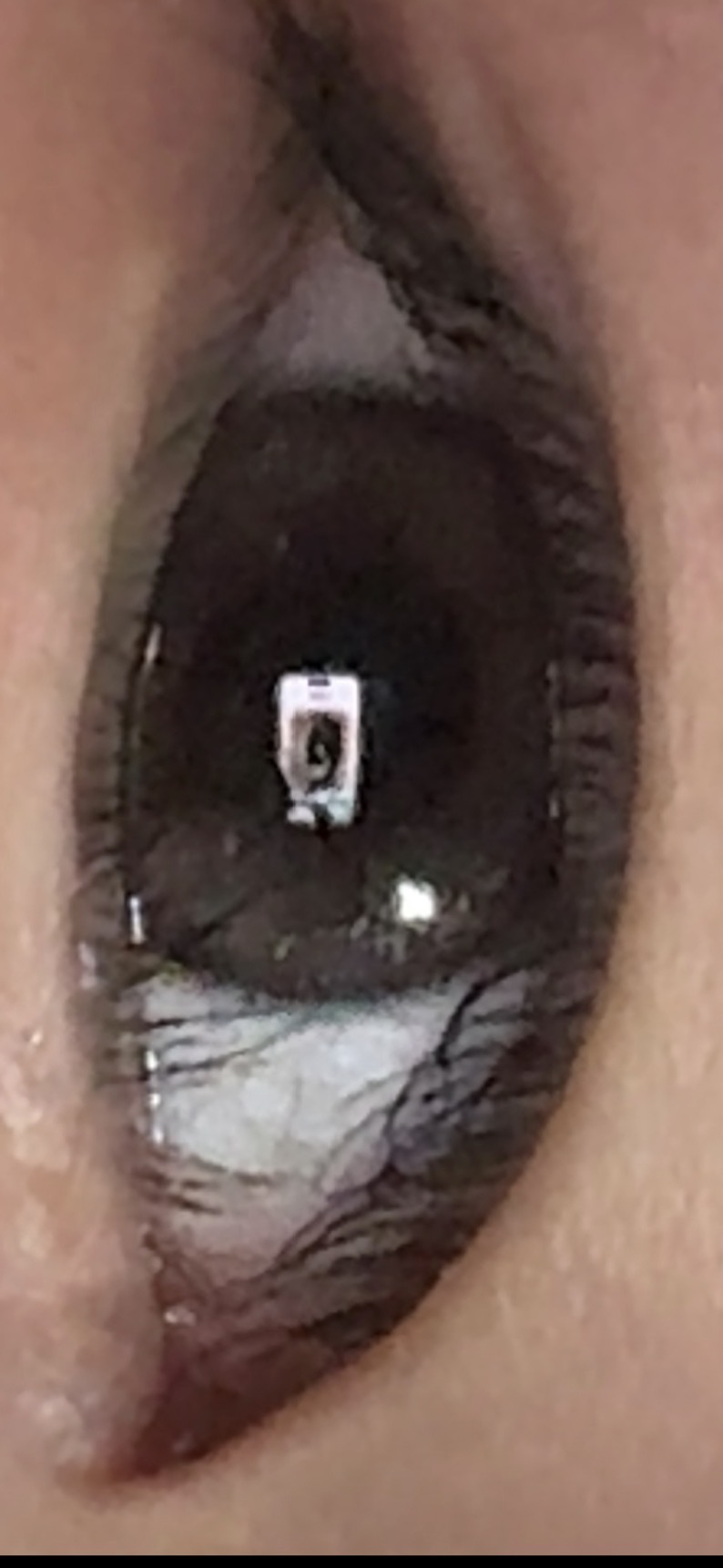UGC003935