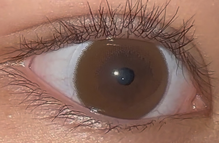 UGC003430