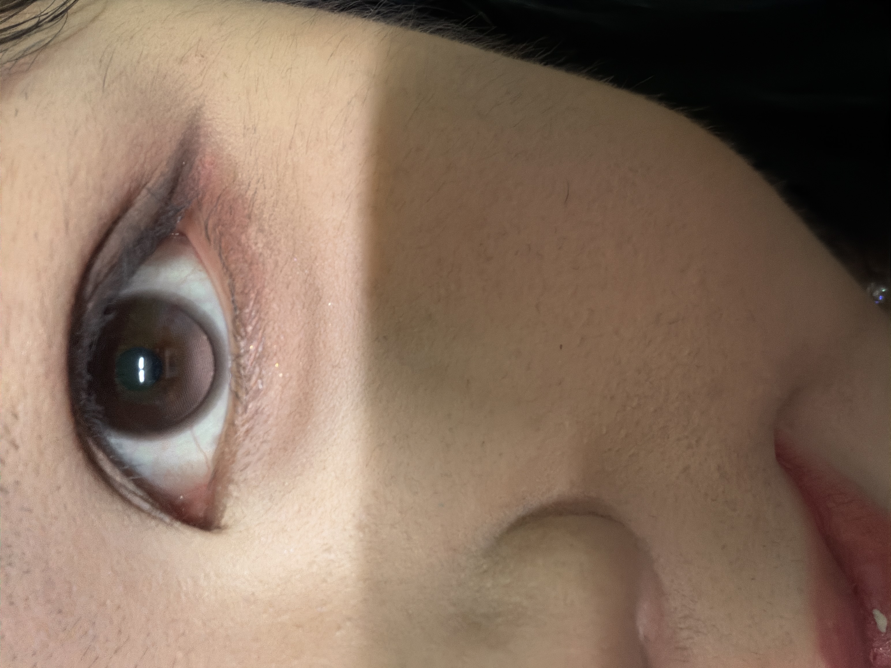 UGC007558