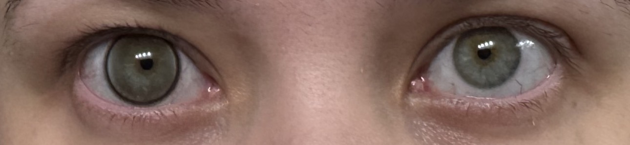 UGC008638