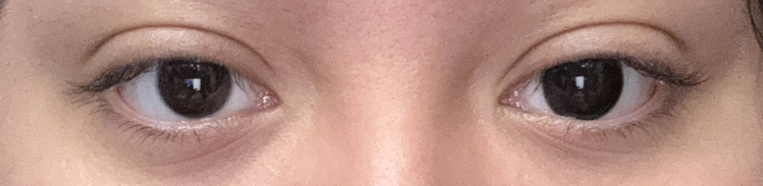 UGC004524