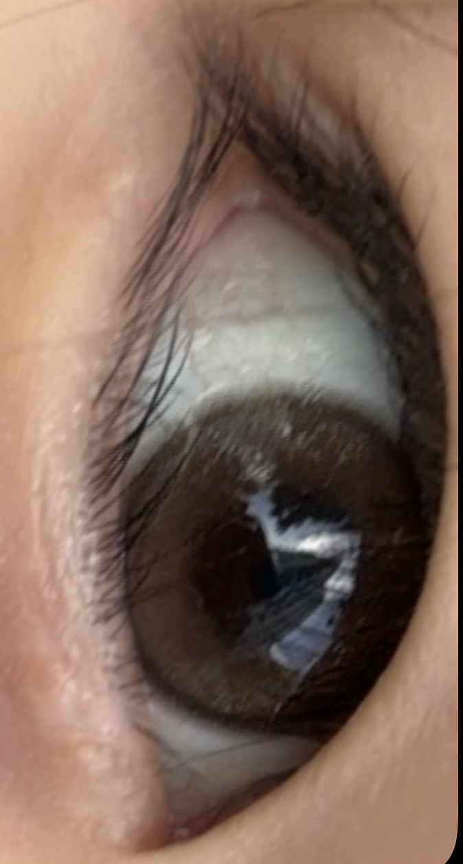 UGC003935