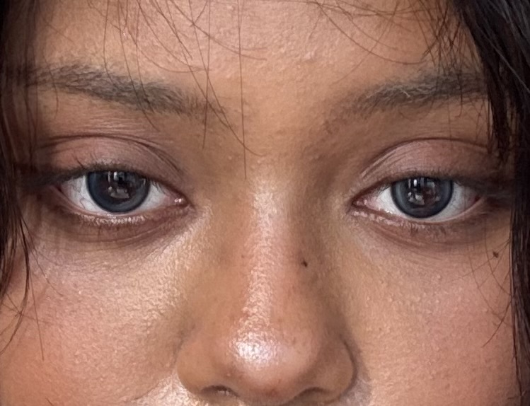 UGC003227