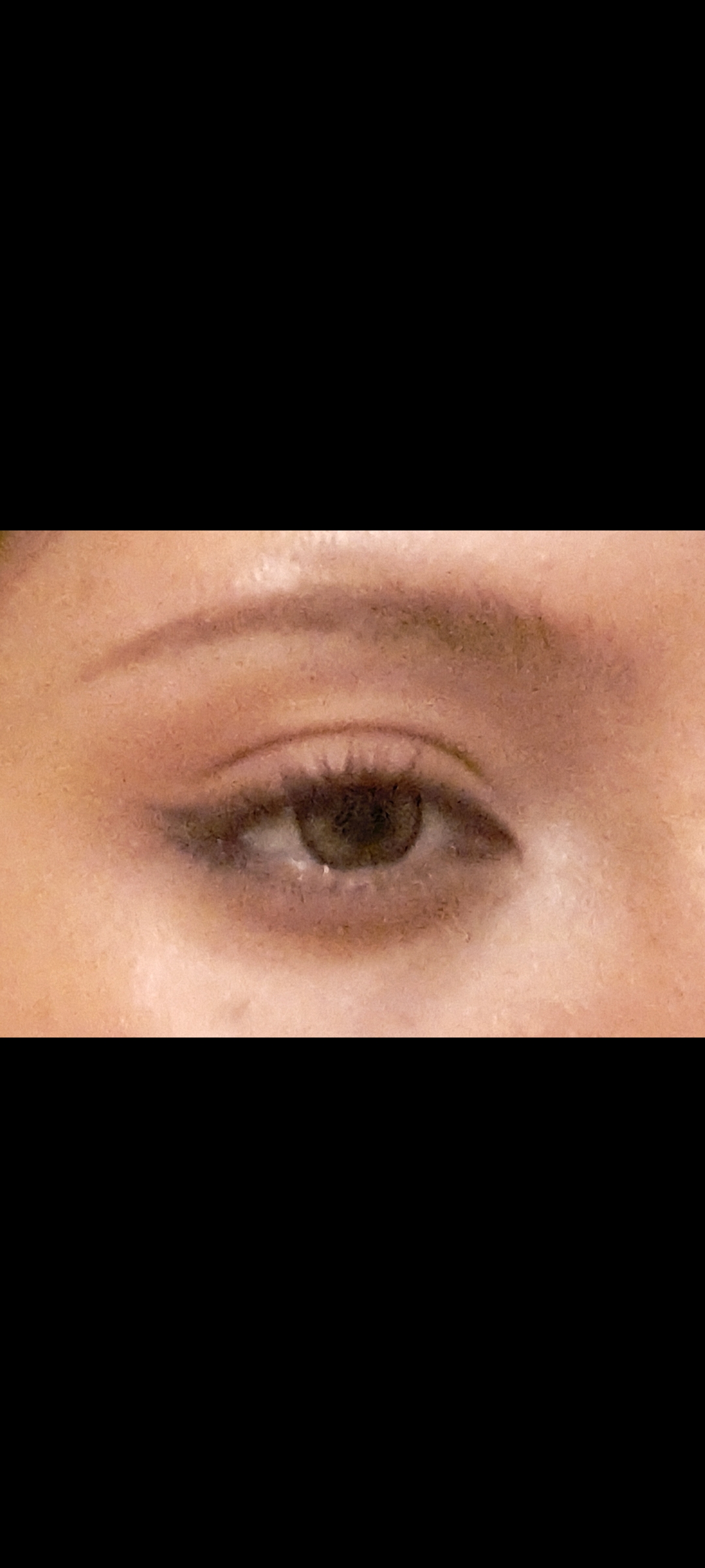 UGC003183